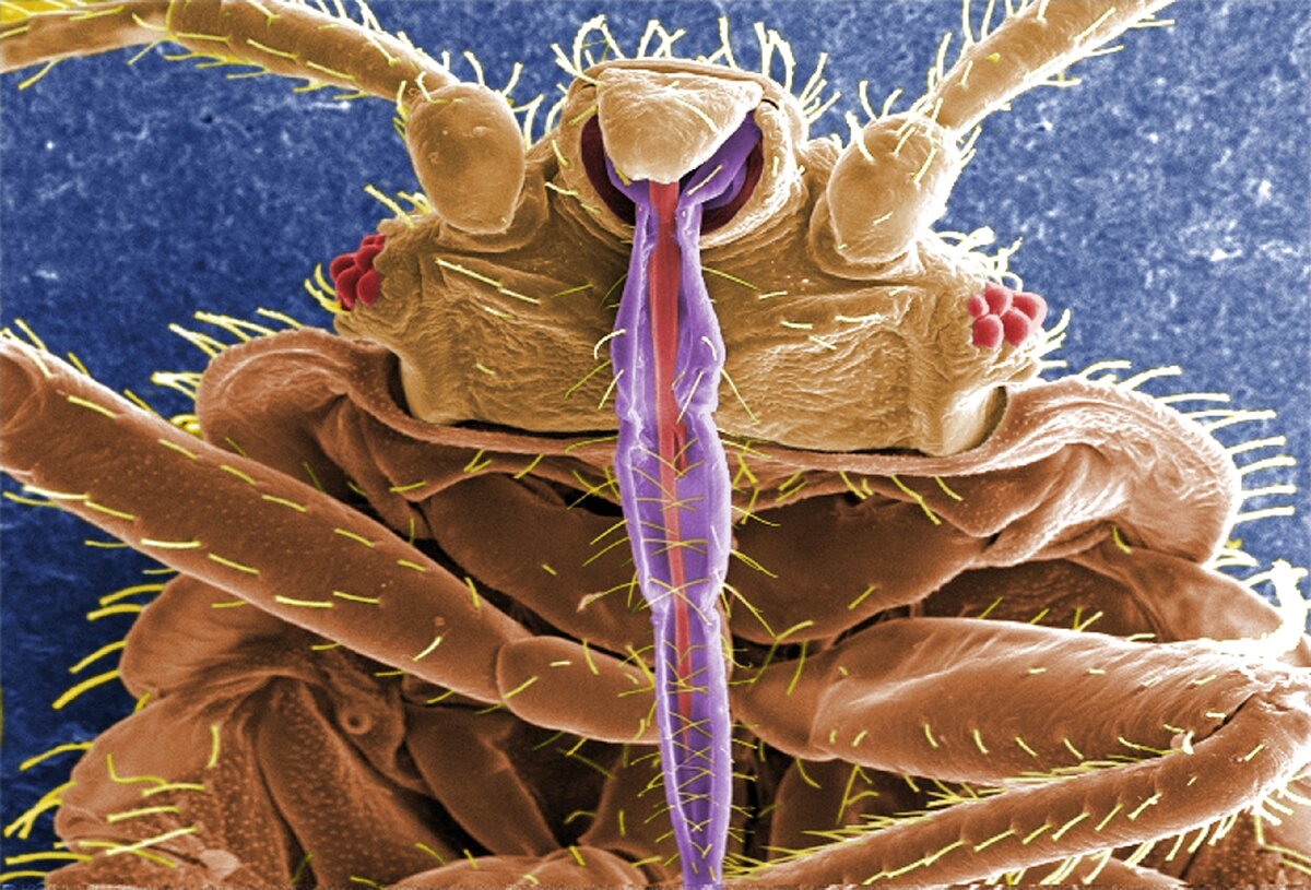 Пылевые клещи под микроскопом. Ротовой аппарат постельного клопа. Клопы Cimex lectularius. Постельный клоп под микроскопом.