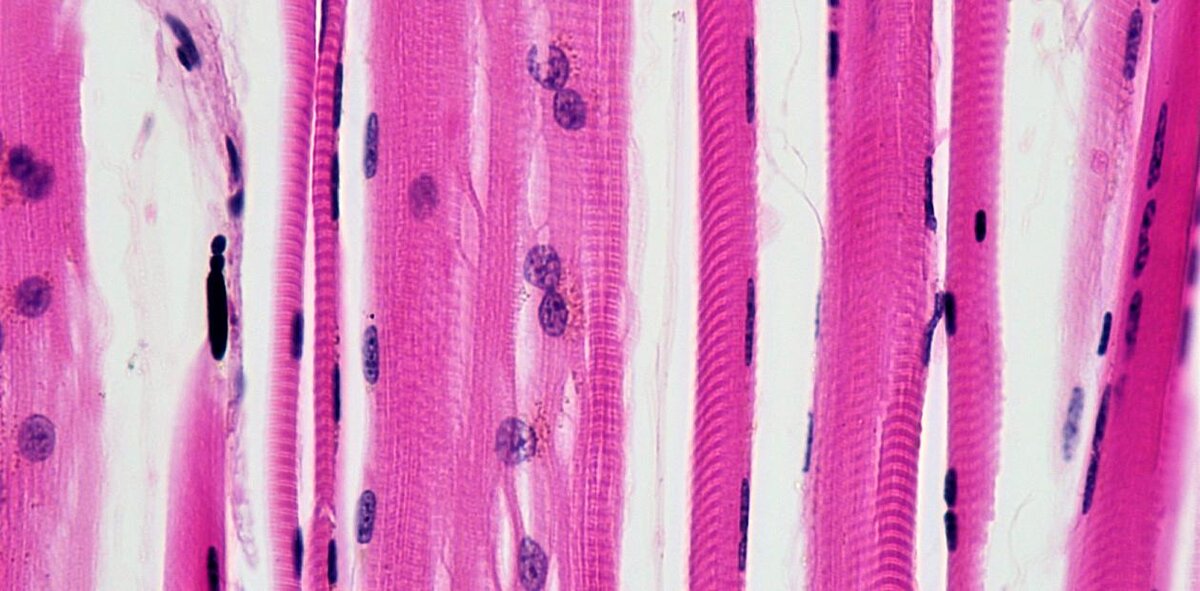 Скелетная мышца