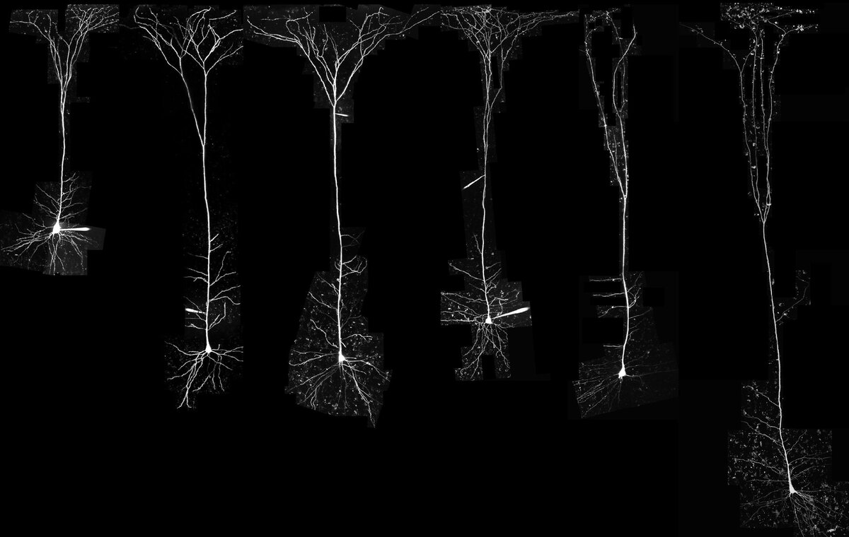 Нейроны разных млекопитающих, от грызунов до человека, которые попали в исследование