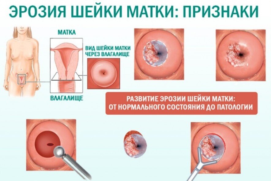 МРТ: взгляд изнутри