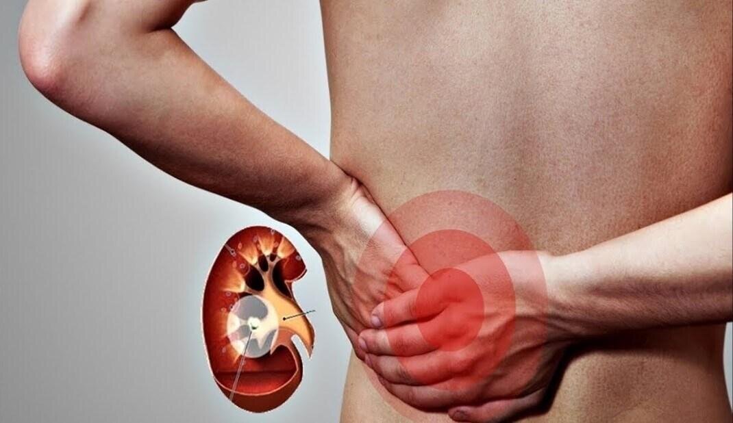 4 boli care se ascund în spatele durerilor de spate