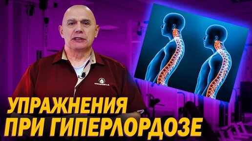 Почему женщинам после 50 важно знать, что такое гиперлордоз, и в чем его отличие от лордоза. Как профилактика может спасти позвоночник