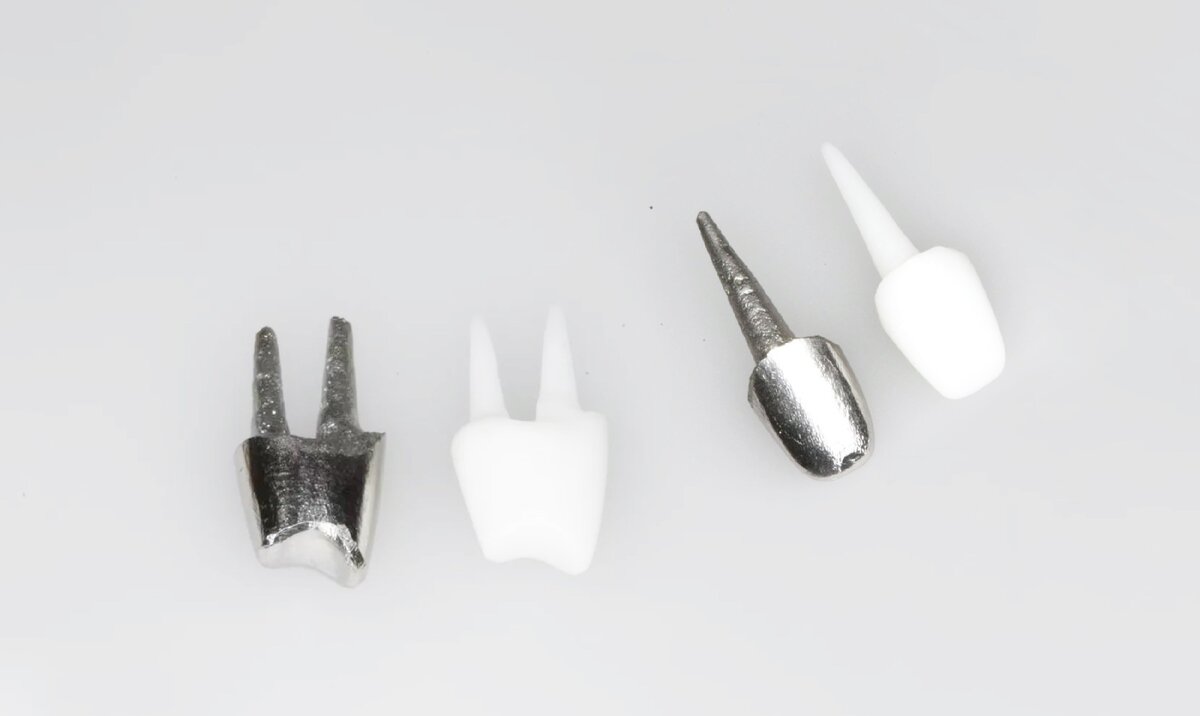 Культевая вкладка на зуб – что это и когда она необходима? | Журнал ...