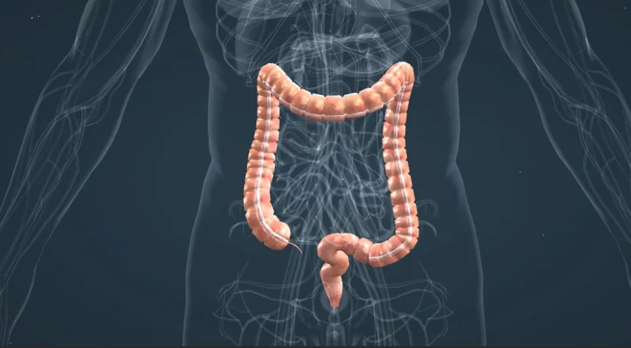 отделы толстого кишечника ободочная кишка. опухоль толстого кишечника. злокачественная опухоль толстой кишки. опухоль печеночного изгиба толстого кишечника. толстый кишечник отделы топография.