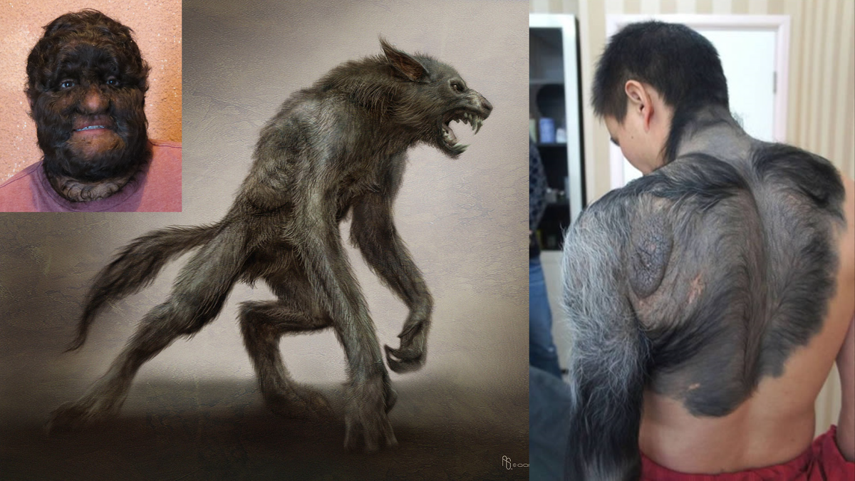 Оборотень - одна из центральных фигур древнейших суеверий. Вместе с вампирами, ведьмами, русалками, призраками и колдунами он существует уже тысячи лет, наводя ужас на взрослых и детей в больших городах и глухих местечках. 
Слово «ликантроп», от которого он получил свое название, буквально означает «человек-волк» и происходит от греческого Likantropia. Некоторые словари определяют это слово как «превращение ведьмы в волка».

Тема человека-волка была популярна в устных преданиях и в хрониках почти по всему миру. Во Франции это чудище было известно как лу-гару, в других частях Европы как вервольф, или верман, волкодлак, или волколок - в Трансильвании, полтеник - в Болгарии.

Начиная с Ромула и Рема истории о волке, человеке-звере и самом оборотне будоражили воображение таких людей как Жан-Жак Руссо, Карл Линней и Джонатан Свифт. Талантливые писатели создали целую серию замечательных произведений об оборотнях.

Однако оборотень не так хорошо известен, как его собрат - злодей вампир. Оборотень многозначнее и таинственнее, чем вампир. Все приписываемые ему мифические качества могут быть довольно легко развенчаны современной наукой, но еще в древние времена действительно существовала некая болезнь, которая поражала целые деревни, превращая людей в неистовых зверей, и эти больные имели все классические симптомы ликантропии. Известно, что в Европе в XVI веке, после кровавых оргий, эти несчастные, подозреваемые в демонизме, преследовались и травились собаками, погибали сотнями.

Интерес к оборотничеству поистине неистощим. В XX веке он выразился в постановке таких фильмов, как «Человек-волк» (1941), «Франкенштейн встречает Человека-волка» (1943), «Женщина-волк в Лондоне» (1946), «Оборотень» (1956), «Я был оборотнем-подростком» (1957), «Оборотень в девичьей спальне» (1961) - это лишь маленькая часть списка из более чем пятидесяти фильмов, указанных в «Справочнике-каталоге фантастических фильмов» Уолта Ли. Вероятно, самым известным оборотнем киноэкрана является Лон Чейни младший, чья кинематографическая трансформация из человека в волка занимала не менее шести часов предварительной подготовки в гримерной, и еще большее время само превращение. Образы оборотней, представляемых фильмами, очень разнообразны, от подлинно художественных, порой даже вызывающих симпатию, до нарочито устрашающих и забавно-кровожадных.

Современная художественная литература и журналистика демонстрирует еще более глубокий подход к теме оборотней, еще более широкое ее рассмотрение.

17 декабря 1976 года, например, лондонская «Дейли мейл» вышла со статьей, озаглавленной «Мы поймали оборотня-убийцу», - говорит полиция», в которой сообщалось о подробностях захвата совершившего многочисленные убийства преступника, известного как «Парижский оборотень». В конце Второй мировой войны нацисты создали террористическую организацию, члены которой творили ужасные злодеяния под кодовым названием «Вервольф» (Оборотень). В применении к уголовным преступникам слово «оборотень» служит как сильная нравственная метафора, когда речь заходит о каких-то нечеловеческих, диких, не поддающихся логике преступлениях, таких как многочисленные убийства, изнасилования, каннибализм, истязания, садомазохизм, сатанизм. Ирония такой оценки заключается в том, что сам волк (если только он не голоден или не ранен) не убивает и не нападает. Согласно недавно проведенным исследованиям, в волчьей стае поддерживаются тесные доверительные отношения, сообщество основывается на взаимной ответственности, и если кто-нибудь из его членов начинает проявлять инстинкты убийцы, его истребляют ради блага всей стаи.

«Подлинные» оборотни в нашем современном обществе - это те, кто появляется в качестве пациентов в психиатрических клиниках и на ритуальных церемониях американских индейцев. О людях (обоих полов), вообразивших и ощущающих себя оборотнями, врачи говорят как о ли-кантропах. Хотя этимологическое различие между словами «оборотень» и «ликантроп» незначительно (оборотень, лат.: человек-волк; ликантроп lykanthropos, греч.: волкочеловек), по своему применению они различаются: слово «ликантроп» служит сегодня профессиональным термином для обозначения патологического состояния, а «оборотень» - не медицинское слово, используемое в художественной литературе, фильмах и для характеристики преступников.

Нам предстоит длинный путь - сквозь века, по разным странам. Но для начала мы позволим себе привести одну историю, которая вызовет у читателя трепет и недоумение; поможет понять, как вся эта мистика могла выжить и сохраниться в наши дни.

В конце XVI века в Оверни жил состоятельный господин по имени Санрош. Жил он на широкую ногу, держал слуг, был счастлив в браке.

Поместье Санроша располагалось на горе. Из многочисленных окон землевладелец и его домашние любовались зелеными склонами, быстрым ручьем, великолепным лесом и дальними горами, виднеющимися в голубоватой дымке.

Однажды в полдень ранней осенью 1580 года Санрош сидел у окна, когда вошедший слуга доложил, что пришел мсье Фероль.

Фероль был известным в округе охотником и рыболовом, а Овернь считалась прекрасным местом для этих занятий: в чистейших реках полно рыбы, а в лесах - птиц, оленей, медведей. Фероль зашел, чтобы пригласить друга вместе выслеживать оленя. Санрош же с сожалением отклонил приглашение - он ждал своего адвоката, который вот-вот должен был зайти по делам. Фероль отправился один.

Адвокат пришел, как было условлено, и больше часа они с Санрошем занимались делами, связанными с поместьем, Санрош даже позабыл о визите своего друга. Проводив адвоката и поужинав, он неожиданно вспомнил о дневном приглашении.

Срочных дел у Санроша больше не предвиделось, жены дома тоже не было, и он, чтобы не скучать в одиночестве, решил пойти навстречу своему другу. Он быстро спускался по тропинке, ведущей в долину, и через несколько минут заметил на противоположном косогоре фигуру своего друга, всю алую в последних лучах солнца. Чем ближе он подходил к другу, тем яснее Санрош видел, что его приятель чем-то взволнован.

Когда они встретились в узкой лощине между двумя косогорами, землевладелец увидел, что платье Фероля изорвано и покрыто грязью и пятнами, похожими на кровь. Фероль был сильно подавлен и едва дышал, так что его друг отложил расспросы и ограничился тем, что взял у охотника мушкет и сумку для дичи. Некоторое время друзья шли молча.

Затем, немного переведя дух, но все еще волнуясь, Фероль рассказал Санрошу о поразительном происшествии, пережитом им в лесу. Вот его рассказ.

Охотнику пришлось довольно долго походить по лесу, прежде чем он увидел невдалеке группу оленей. Подобраться же к ним поближе, чтобы сделать выстрел, ему никак не удавалось. В конце концов, преследуя их, он зашел в чащу и почувствовал, что на обратную дорогу потребуется немало времени.

Повернув домой, Фероль вдруг услышал жуткое рычание, раздавшееся из сырого, заросшего папоротником оврага. Медленно пятясь и не спуская глаз с того места, охотник, шаг за шагом, преодолел около полусотни метров, когда огромный волк выскочил из оврага и бросился прямо на него.

Фероль приготовился к выстрелу, но оступился - его сапог попал под корень - и выстрел не попал в цель. Волк с бешеным рыком прыгнул на охотника, пытаясь вцепиться ему в горло.

К счастью, у Фероля была хорошая реакция - он ударил зверя прикладом, и тот рухнул на землю. Почти сразу же волк опять вскочил. Фероль успел выхватить охотничий нож и храбро шагнул навстречу готовящемуся к прыжку зверю. Они сошлись в смертельной схватке. Но секундная передышка и опыт помогли охотнику, он успел намотать плащ на левую руку и сунул ее в пасть зверю. Пока тот тщетно старался добраться своими острыми клыками до руки, Фероль наносил удары кинжалом, пытаясь перерезать животному горло. Охотничий кинжал Фероля с широким и острым, как бритва, лезвием, с огромной рукояткой был почти таким же увесистым, как небольшой топорик

Человек и зверь упали на землю и в яростном поединке покатились по листьям. В какой-то момент они оказались у поваленного дерева, и лапа зверя, свирепо смотревшего на охотника налитыми кровью глазами, зацепилась за корявый ствол. В тот же момент Фероль ударил по ней ножом и перерубил острым лезвием плоть, сухожилия и кость. Волк жутко и тоскливо завыл и, вырвавшись из объятий охотника, хромая, убежал прочь. Фероль, забрызганный кровью зверя, в изнеможении сидел на земле. Плащ был разорван на полосы, но он с облегчением обнаружил, что благодаря импровизированной защите на руке остались лишь поверхностные царапины. Охотник зарядил мушкет, намереваясь найти и добить раненого зверя, но потом решил, что уже поздно, и если он еще задержится, то ему придется добираться до дома своего друга в темноте.

Можно представить, с каким волнением слушал Санрош этот подробный рассказ, то и дело прерывая его восклицаниями удивления и испуга. Друзья медленно брели и, наконец, вошли в сад Санроша. Фероль указал на свой мешок. «Я прихватил лапу зверя с собой, - сказал он, - так что ты можешь убедиться в правдивости моего рассказа».

Он склонился над мешком, стоя спиной к другу, так что Санрош не мог сразу увидеть, что тот вытаскивает. Сдавленно вскрикнув, охотник что-то уронил на траву. Он повернулся, и Санроша поразила его смертельная бледность.

«Я ничего не понимаю, - прошептал Фероль, - ведь это же была волчья лапа!»

Санрош нагнулся, и его тоже охватил ужас: на траве лежала свеже-отрубленная кисть руки. Его ужас еще усилился, когда он заметил на мертвых изящных пальцах несколько перстней. Один из них, искусно сделанный в виде спирали и украшенный голубым топазом, он узнал. Это был перстень его жены.

Кое- как отделавшись от совершенно сбитого с толку Фероля, Санрош завернул кисть в платок и, спотыкаясь, поплелся домой. Его жена уже вернулась Слуга доложил, что она отдыхает и просила ее не беспокоить. Зайдя в спальню жены, Санрош нашел ее лежащей в кровати в полубессознательном состоянии. Она была смертельно бледна. На простынях виднелась кровь. Вызвали доктора, и он смог спасти жизнь мадам Санрош искусной обработкой раны: кисть ее руки оказалась отрубленной.

Санрош провел несколько мучительных недель, прежде чем решил поговорить с женой об этой истории. В конце концов несчастная женщина призналась, что она оборотень. Видимо, Санрош был не очень хорошим мужем, поскольку он пошел к властям и донес на нее. Началось судебное разбирательство, и после пыток женщина созналась в своих злых делах. Вскоре мадам Санрош была сожжена у столба, и больше Овернь оборотни не тревожили.

Эта история в том или ином варианте сохранилась во многих источниках того времени. Определенно, она - одна из наиболее ярких иллюстраций страшного явления. Теперь же наступило время назвать все своими именами, попытаться пролить свет на эту загадочную историю.

Оборотень и его отвратительные дела были известны уже во времена основания Рима. Этого существа боялись и в Древней Греции. Но, как и в историях с вампирами, более всего присутствие оборотней проявлялось в Восточной Европе, где лишь при одном упоминании о волкодлаке крестьянин бледнел и с тревогой оглядывался вокруг.

Франция изрядно натерпелась от лу-гару, и народные легенды содержат множество рассказов об охотах на человеко-зверей, обитавших в горах. Вполне естественно, что эти легенды больше распространены в сельских и горных районах, таких, как Овернь и Юра, где волки причиняли много хлопот пастухам. Германия пережила немало от этой напасти. Что же касается ее распространения на север, то хотя Англия, видимо, не была слишком ей подвержена, сохранившиеся записи свидетельствуют, что в Ирландии оборотни обитали.

В отличие от вампира, выходящего из могилы, чтобы пить кровь живых людей, оборотень не является выходцем с «того» света. Он - явление чисто земное. Похоже, что превращение человека в оборотня вызывалось некой болезнью, которая могла поразить любого. Укушенный оборотнем заражался обязательно, но ужасные симптомы могли появиться У человека и тогда, когда он в безопасности сидел у себя дома и не делал ничего, что могло бы определить ему такой удел. Именно с этим были связаны дикий страх и массовые казни в средние века, когда подозреваемых в том, что они оборотни, сжигали и предавали мечу. Ужасна была ярость, с которой в народе встречали проявления присущих, как считалось, оборотням признаков, а примитивные суды и массовые казни походили на всеобщую истерию. Во время вспышек неистового массового страха человек, слегка тронутый безумием или «смахивающий» на волка - имеющий острые зубы, худое вытянутое лицо, - мог легко оказаться под подозрением и угодить в суд.

Больше всего боялись полнолуния, поскольку считалось, что напасть поражает в это время особенно часто. «Пораженные луной» обнаруживали, что их тела изменились мерзким, отвратительным образом, они начинали походить на волка и вести себя, подобно этим зверям. Претерпев такие превращения, они отправлялись в ночные скитания и убивали любого, кто попадется им на пути. Вполне вероятно, что они представляли собой жуткое бедствие. Чтобы человек превратился в вампира, на него должен напасть другой вампир. Но ликантропия может неожиданно поразить любого человека, и от нее нет спасения - ни чеснок, ни облатки, ни крест не помогают…

Как повествуют древние трактаты, истинный ликантроп не только изменяется физически, так что своим обликом начинает походить на зверя, но меняется и его разум, поведение. Он ощущает себя только зверем. В отличие от вампира он не ограничивается ночными действиями, встреча с ним грозит бедой и в солнечный день. Но все же лунный свет особенно опасен. В полнолуние человек рискует особенно.

Пораженный ликантропией очень быстро изменялся внешне. Начало приступа часто сопровождалось ощущением легкого озноба, который затем сменялся лихорадкой. Человек испытывал головную боль и страдал от сильнейшей жажды. Руки начинали пухнуть и удлиняться и, как и у больных проказой, кожа лица и конечностей грубела и расплывалась.

Испарина и затрудненное дыхание тоже часто сопутствовали превращению, принимающему затем более определенную форму. Ногам начинала мешать обувь, и жертва ее сбрасывала, пальцы ног искривлялись и делались цепкими. Рассудок жертвы тоже менялся: ей становилось неуютно и тесно в доме и хотелось выбраться наружу.

Затем вместе с тошнотой и спазмами приходило полное помутнение рассудка, в груди начиналось жжение, язык отказывался повиноваться, вместо членораздельной речи существо издавало гортанное бормотание. Когда наступала эта стадия, ликантроп сбрасывал одежду и вставал на четвереньки, туловище его темнело, покрываясь матовой шерстью. Затвердевали подошвы ног - голый человек-зверь мог бегать по острым камням и колючкам так, как не смог бы нормальный человек с чувствительной кожей.

Голова зарастала грубым волосом так, что казалось, будто человек надел маску животного. Потом, особенно в полнолуние, ликантропом всецело овладевала жажда крови, подавляя все остальные чувства. И он убегал в ночь, воя на луну и убивая всех - животного или человека, - кто попадался ему на тропе.

Обычно он убивал, как и большинство хищников, прокусывая шейные артерии. Удовлетворив свою кровожадность, ликантроп падал в лесу на землю и засыпал. К утру человек-волк снова становился человеком. Убийства ночью, раскаяние днем - такова была ужасная участь душегуба-оборотня.

Ликантроп всегда чувствовал, как начинались эти изменения, но все происходило так быстро, что страдающие этой болезнью должны были принимать специальные меры, чтобы предотвратить свое разоблачение. Те, у кого дома были достаточно велики, скрывались в потайных комнатах до тех пор, пока опять не становились самими собой. Другие, если приступ начинался ночью, бежали в леса и там рычали и катались по земле, кусая и царапая стволы деревьев, а после терзались муками разума в такой же степени, как и муками тела.

У ликантропа было мало шансов на исцеление. Он был обречен блуждать каждую ночь, пока какое-нибудь существо, более сильное, чем он, не уничтожит его или пока серебряная пуля не положит конец его страданиям. Правда, оборотни в отличие от вампиров могли быть убиты и обычными способами, но самым эффективным средством считалась специально изготовленная серебряная пуля, верно поражавшая чудовище насмерть. Это мнение было широко распространено в некоторых областях Европы до XVIII века так же, как и старая история о том, что оборотень всегда носит с собой свой толстый, лохматый волчий хвост. Люди полагали, что эта физическая особенность всегда сохраняется при ликантропии, и при осмотрах доктора неизменно осведомлялись о его наличии.

Существовало также мнение, что, если спрятать или сжечь одежды подозреваемого оборотня, он не сможет вернуть свой человеческий облик. Это суеверие было особенно распространено в Восточной Европе и России.

Во многих странах святая вода считалась эликсиром против напасти. Люди верили, что, вылитая на подозреваемого ликантропа, она физически сжигает шерсть и очищает жертву.

Ситуация, в которой оказывался подозреваемый в ликантропии, была в самом деле ужасной. Эта напасть создавала целый комплекс нравственных и религиозных проблем в век, когда церковь играла важную роль буквально во всех ежедневных человеческих делах.

Если власти узнавали о существовании ликантропа, его ждала страшная участь. Максимум, на что он мог рассчитывать, - быстрая и легкая смерть, но такой милости несчастного удостаивали редко. Обычно оборотней предавали публичному суду, сопровождаемому пытками, а затем отправляли на ужасную казнь, чаще всего сожжение.

Да и доказательства виновности оборотня добывали весьма жестокими способами. С одним мы уже познакомились в истории о мадам Сан-рош. Чаще же ликантропа выслеживали по кровавому следу, приводившему к человеку, или, если раненый зверь не оставил следов, искали человека, имевшего рану или повреждение там же, куда был ранен и волк.

Был и еще один «безошибочный» способ, помогающий выявить оборотня. Во время превращения в волка возрастающая жажда крови соединялась у несчастного с неудержимым желанием сорвать с себя всю одежду, и, срывая ее, он, естественно, ранил себя; кожа повреждалась и, будучи уже волком, он бежал по лесу. Поэтому, когда преследователи, среди которых часто были одержимые местью родственники жертв, врывались в дом подозреваемого, его часто заставляли раздеться и предательские следы становились явственно видны на уже человеческой коже…

Гораздо более жестокий способ определения оборотня породило верование, широко распространенное в Германии, во Франции и в Восточной Европе, будто оборотень может поменять свою кожу, просто выворачивая ее наизнанку, то есть если он появлялся в человеческом облике - значит, он просто вывернул наружу человеческую кожу. А когда он опять будет превращаться в волка, он поменяет покров, вывернув наружу мех. Трудно поверить, но многие люди были буквально порезаны на куски «правдоискателями», пытавшимися вывернуть их кожу «мехом наружу».

Человек упрям по своей натуре, он верит в то, во что хочет верить, и инквизиторы, не останавливаясь перед кровопролитием, надеялись получить более осязаемые доказательства в своей праведной борьбе с силами тьмы. Учитывая время и обстоятельства, их можно понять, хотя простить нельзя.

Неизвестно точное число людей, которых повесили и сожгли, обвинив в ликантропии, но количество жертв, как свидетельствуют старинные записи, было значительным. Очевидно, большинство из этих людей были чисты перед Богом и людьми.

И не удивительно, хотя в столь печальном положении жертвы «правосудия» отчаянно, с величайшей хитростью и изобретательностью искали средства к спасению.

Рассмотрим несколько основных способов, к которым, как считалось, прибегали люди-волки, чтобы скрыть свою беду.

В полнолуние, когда ликантроп был особенно подвержен приступам болезни, он запирался в комнате и выбрасывал ключ в темноту, а когда приступ кончался, ему приходилось искать средства, чтобы выбраться наружу. Другие изготавливали хитрые ремни, которыми привязывали себя к кровати. Часто оборотни устраивали убежища в доме, где-нибудь в потайном месте, возможно, под самой крышей, чтобы весь шум заглушался. Окна в своих домах оборотни стремились закрыть решетками, а двери закладывали засовами Применялись специальные запоры, неподвластные зверю, но которые мог открыть человек

Однако все эти меры, тщательно подготовленные, лишь на короткое время оттягивали неизбежное разоблачение. Главная беда несчастных «волков» заключалась в том, что не существовало медицинского средства против этой болезни.

Оборотни несли с собой и еще одну беду. Считалось, что истинный оборотень может физически превращаться в настоящего волка. Французские, испанские, итальянские легенды рассказывают о том, что часто какой-нибудь простой крестьянин отвечал за проделки зверя.

Однако надо помнить, учили старинные записи, что, кроме «оборотней-жертв», существовали и оборотни «по желанию». Этим людям доставляло удовольствие быть жестокими. Некоторые верили, что для превращения человека в зверя можно эффективно использовать растения, и в период между XV и XIX веками те, кто пытался стать волком, не раз замешивали диковинное варево.

Философы и другие ученые на протяжении столетий вели споры: были ли оборотни на самом деле? Допуская в принципе возможность психических отклонений, выражавшихся в том, что больные ощущали себя дикими зверями, многие авторитеты придерживались мнения, что существовать настоящие ликантропы в принципе не могут.

Говоря об истинном оборотне, который способен превращаться в волка при помощи черной магии или каких-либо других сил, доминиканские монахи Джеймс Шпрингер и Генрих Крамер, категорично заявляли:

«Это невозможно». Они утверждали, что с помощью различных снадобий и заклинаний колдун или чародей может заставлять того, кто на него смотрит, вообразить, что он превратился в волка или другое животное, но физически превратить человека в зверя невозможно.

Но тем не менее ликантропия как болезнь, заставляющая человека думать, что он превратился в зверя и должен вести себя соответственно, известна с самых древних времен.

Еще примерно в 125 году до н. э. римский поэт Марцелл Сидет писал о ликантропии, указывая, что пораженного человека охватывает мания, сопровождающаяся ужасным аппетитом и волчьей свирепостью. Согласно Сидету, люди сильнее подвержены ей в начале года, особенно в феврале, когда болезнь наиболее распространена и может наблюдаться в самых острых формах.

Подвергшиеся ее влиянию потом удаляются на заброшенные кладбища и живут там, точно свирепые голодные волки. Считалось, что оборотень - это скверный человек, которого боги превратили в зверя в наказание. В средние века, особенно в Центральной и Восточной Европе, родилось мнение, что оборотнями становятся в результате злых козней ведьм и колдунов, и как следствие суеверий во множестве применялись замысловатые процедуры, способные якобы спасти от колдовства.

В греческих легендах тоже можно найти множество упоминаний о волках и о превращении людей в зверей Например, в одной из легенд говорится, что в Аркадии люди превращали себя в волков в ходе специальной церемонии посвящения. Желающих стать волками отводили на глухие болота, там они снимали свои одежды и перебирались через топь на особый остров На этом острове вновь прибывшие принимались такими же волками-людьми и жили среди них как равные.

В Европе в средние века образ оборотня распространился на других животных; люди верили, что человек способен превращаться в медведя, свинью и даже овцу, хотя трудно представить, что в последнем случае он сумел бы нагнать много страха на свою «жертву»! И в наши дни это верование в сути своей сохраняется. Некоторые истории, дошедшие до нас из прошлого, вызвали много споров между зоологами и историками.

В то, что человек может стать волком, верят и по сей день в таких районах, как Нормандия и Бретань; в последней народные предания соответствуют классическому образцу - человек носит волчью шкуру, что позволяет ему перенять часть звериных свойств, а затем он буквально превращается в волка. Однако эти легенды оставляли оборотню шанс на спасение: считалось, что если ликантропа поцарапать возле кончика носа, чтобы выделились три капельки крови, то наваждение рассеется. В Норвегии же думали, что в оборотня превращался человек, отлученный от церкви.

В округе Кот-д'Ор (Франция) легенды об оборотнях имеют странную деталь: считается, что человек может быть оборотнем только определенный срок, обычно десять либо семь лет. Откуда взялись эти цифры? Видимо, мы никогда этого не узнаем.

Большая часть историй, касающихся ликантропии, французского или немецкого происхождения. Но множество вполне достоверных рассказов об оборотнях и о ликорексии (состоянии, когда человек вдруг начинает воображать себя волком и испытывает волчий аппетит вместе с другими ужасными симптомами) существует и в таких странах, как, например, Австрия или Россия. Однако у славянских народов легенды об оборотнях очень тесно переплетаются с легендами о вампирах.

С ликантропией сталкивались многие народы и во все времена. Известно великое множество легенд на эту тему. Но несмотря на то, что эти легенды рождались в разное время и в разных местах, они удивительно похожи друг на друга и отличаются порой лишь мельчайшими деталями.