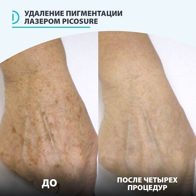 Фотографии предоставлены клиникой лазерной косметологии Delete, https://delete.ru/