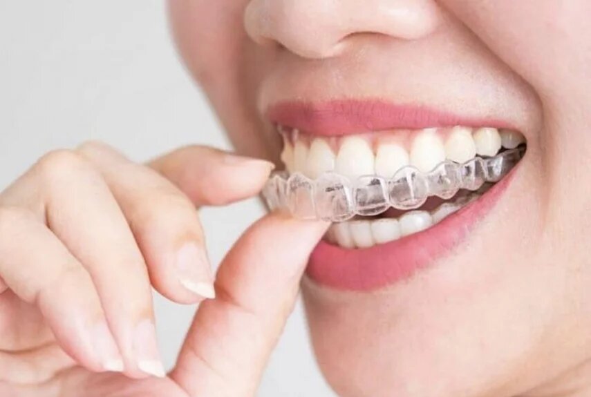 Фото: ООО «Дента-профит»