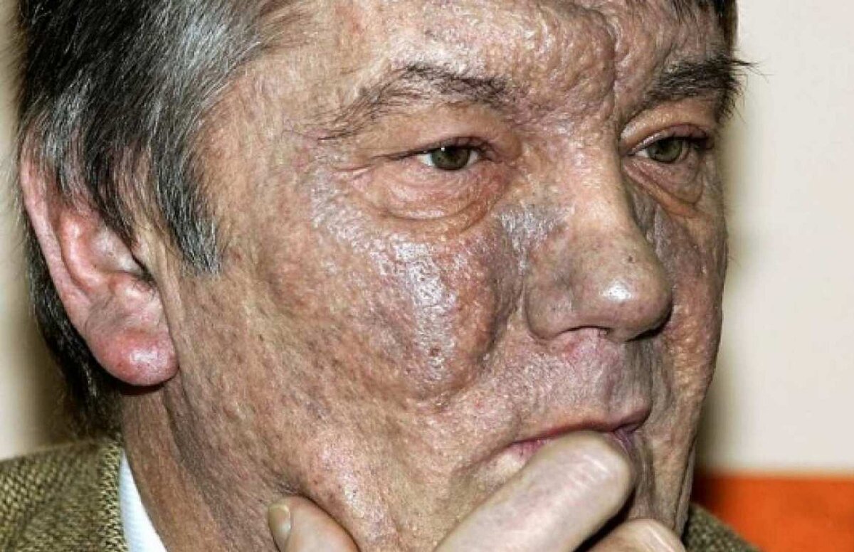 Отравленный Ющенко