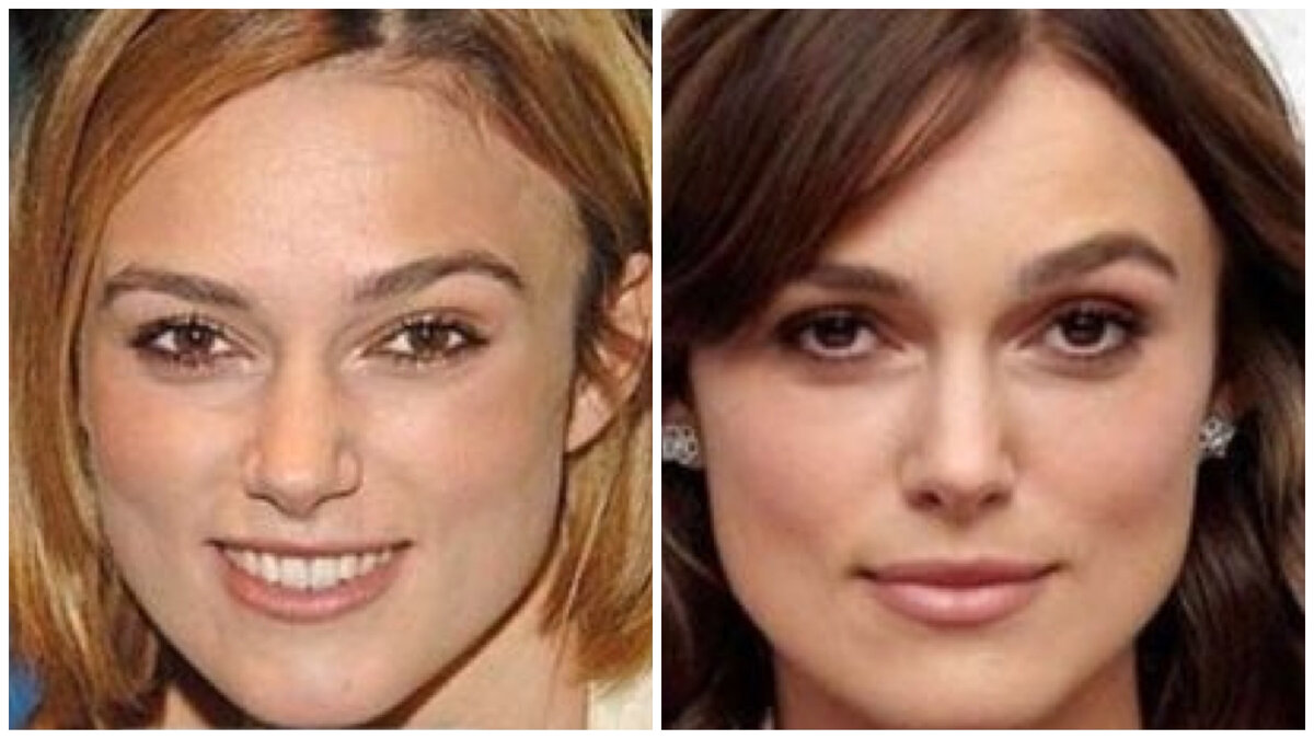 #knightley #plastic #surgery #keiraKeira Knightley Plastic SurgeryKeira Knightle