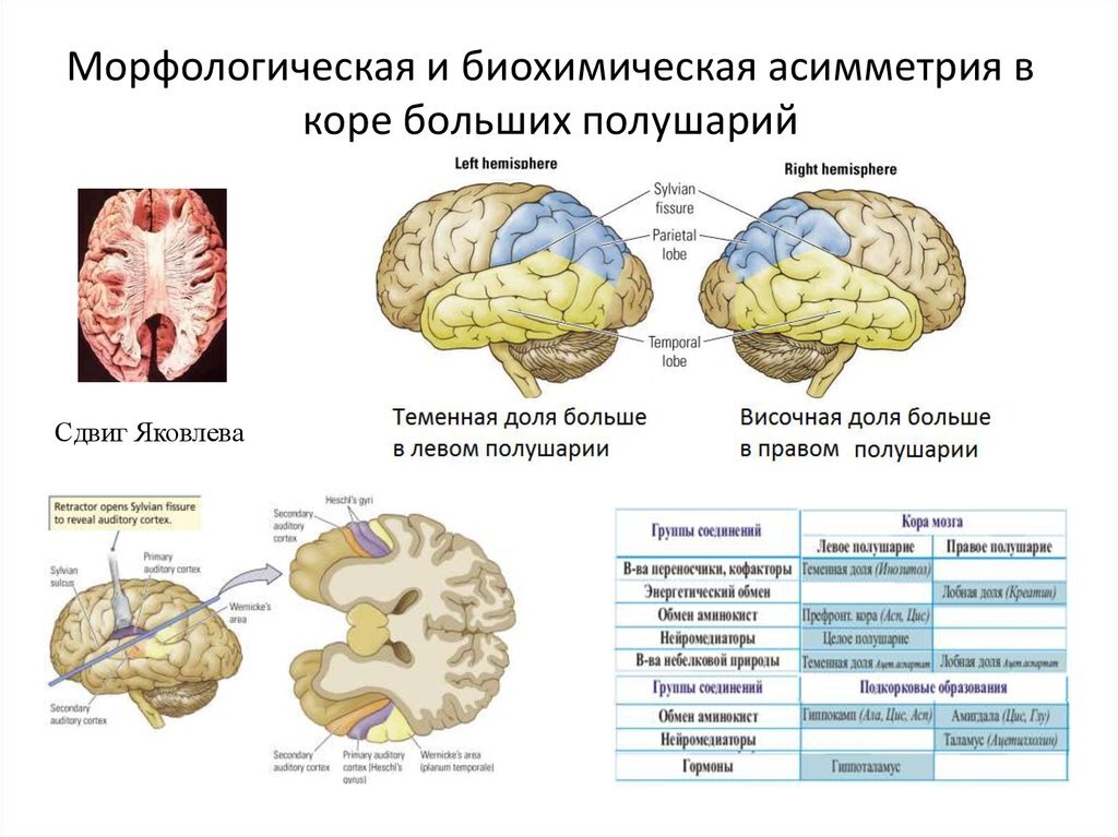 Нарушение коры полушарий. Асимметрия полушарий головного мозга. Асимметрия функций в коре больших полушарий.. Функциональная асимметрия коры больших полушарий. Функциональная асимметрия коры головного мозга.