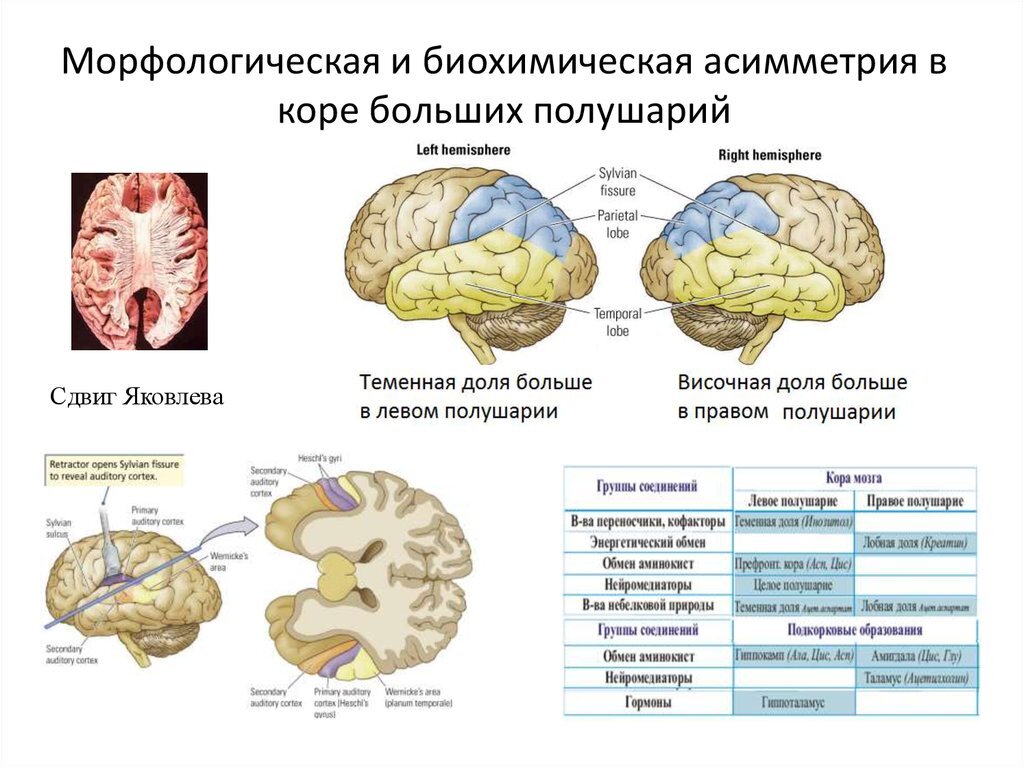 Очаговые изменения больших полушарий. Асимметрия полушарий головного мозга. Асимметрия функций коры больших полушарий. Функциональная асимметрия коры головного мозга. Функциональная асимметрия коры больших полушарий физиология.