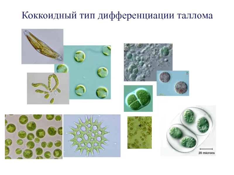 Формы таллома. Коккоидный таллом у водорослей. Коккоидный Тип дифференциации таллома. Коккоидный Тип таллома. Пальмеплоидный Тип таллома.