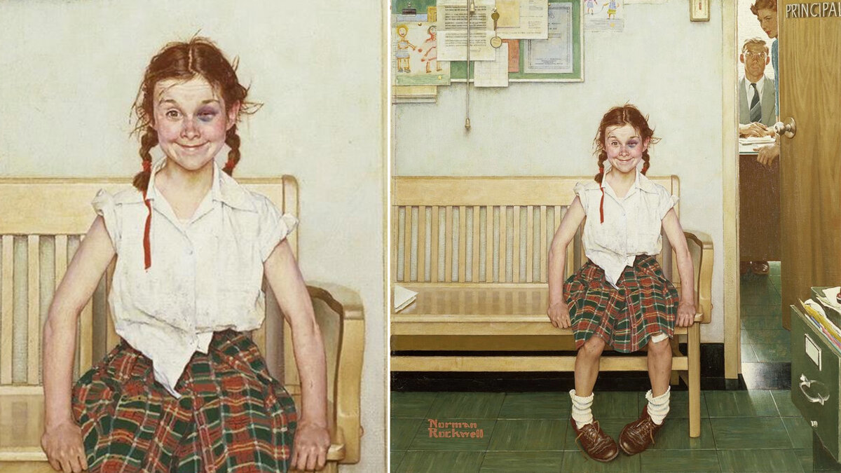 «Молодая леди с синяком», Норман Роквелл, 1953 г. © Музей Wadsworth Atheneum, США