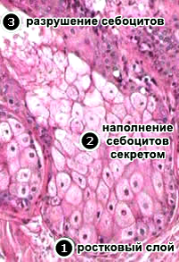 Расположение и вид себоцитов на разных стадиях