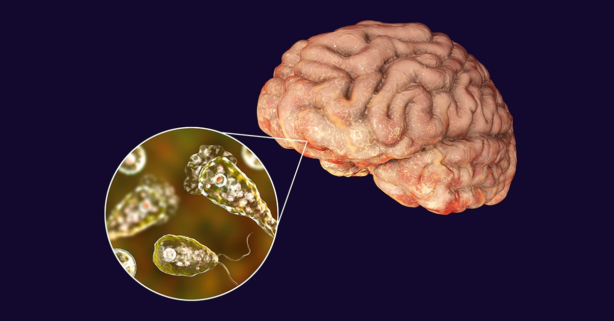 Brain eating amoeba. Амеба неглерия Фоулера. Амебный менингит энцефалит.