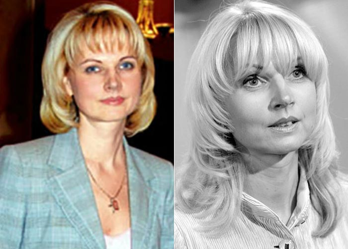 Голикова до и после пластики