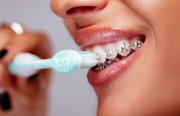 Публикация на сайте - https://ed-m.ru/Poleznye-statqi/Gigiena/how-to-clean-braces