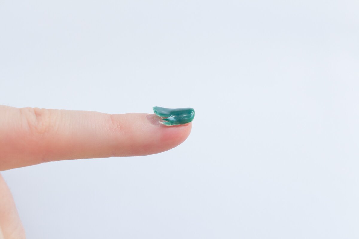 Случай, когда гель-лак начал сходить со всей площади ногтя. 