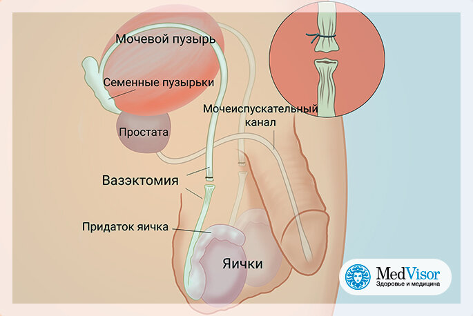  Designed by timdwilliamson/wikimedia