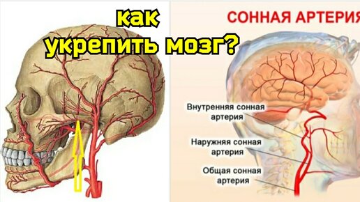 Спазм сонных артерий мешает крови течь в мозг, создаёт мозговой песок, ускоряет старение. Методы улучшения мозгового кровообращения