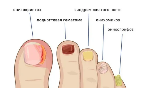 взято из общего доступа