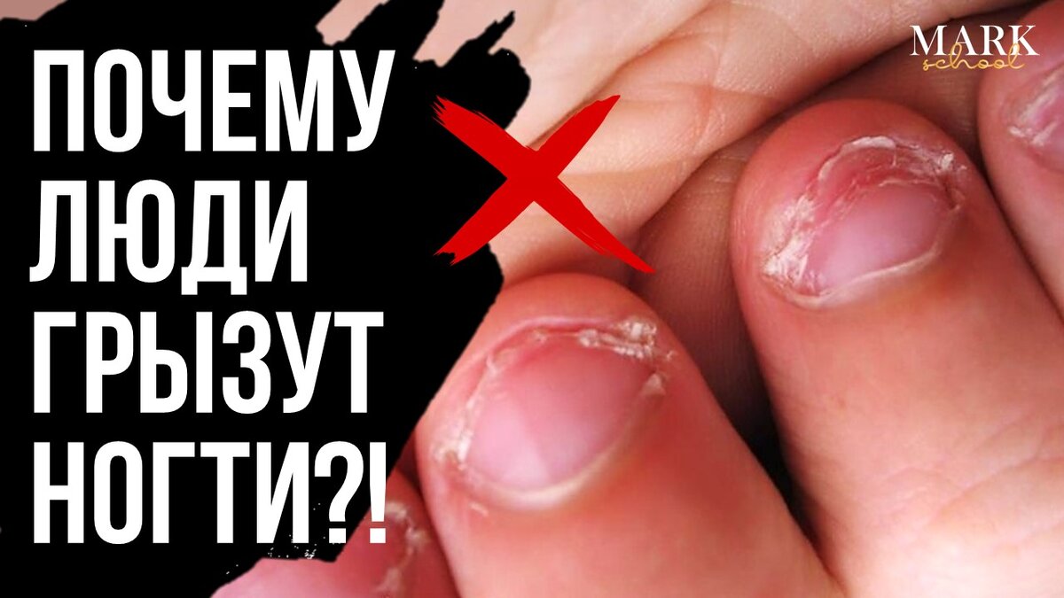 Как перестать грызть ногти: 5 простых шагов