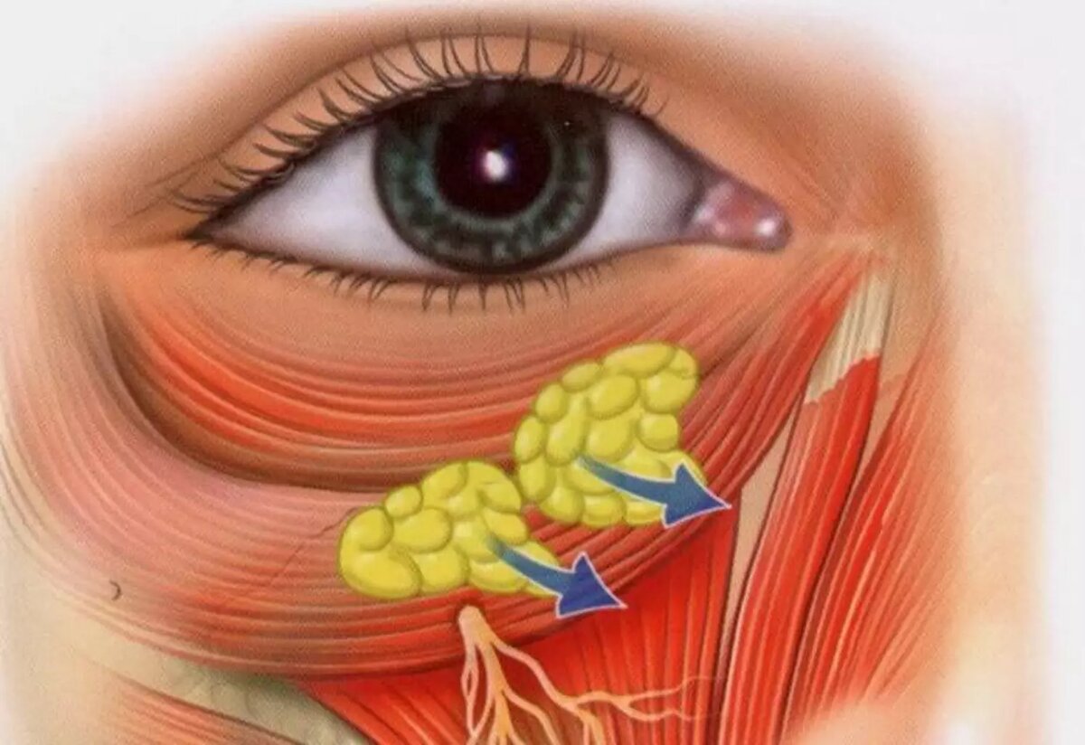 Грыжи под глазами фото причины