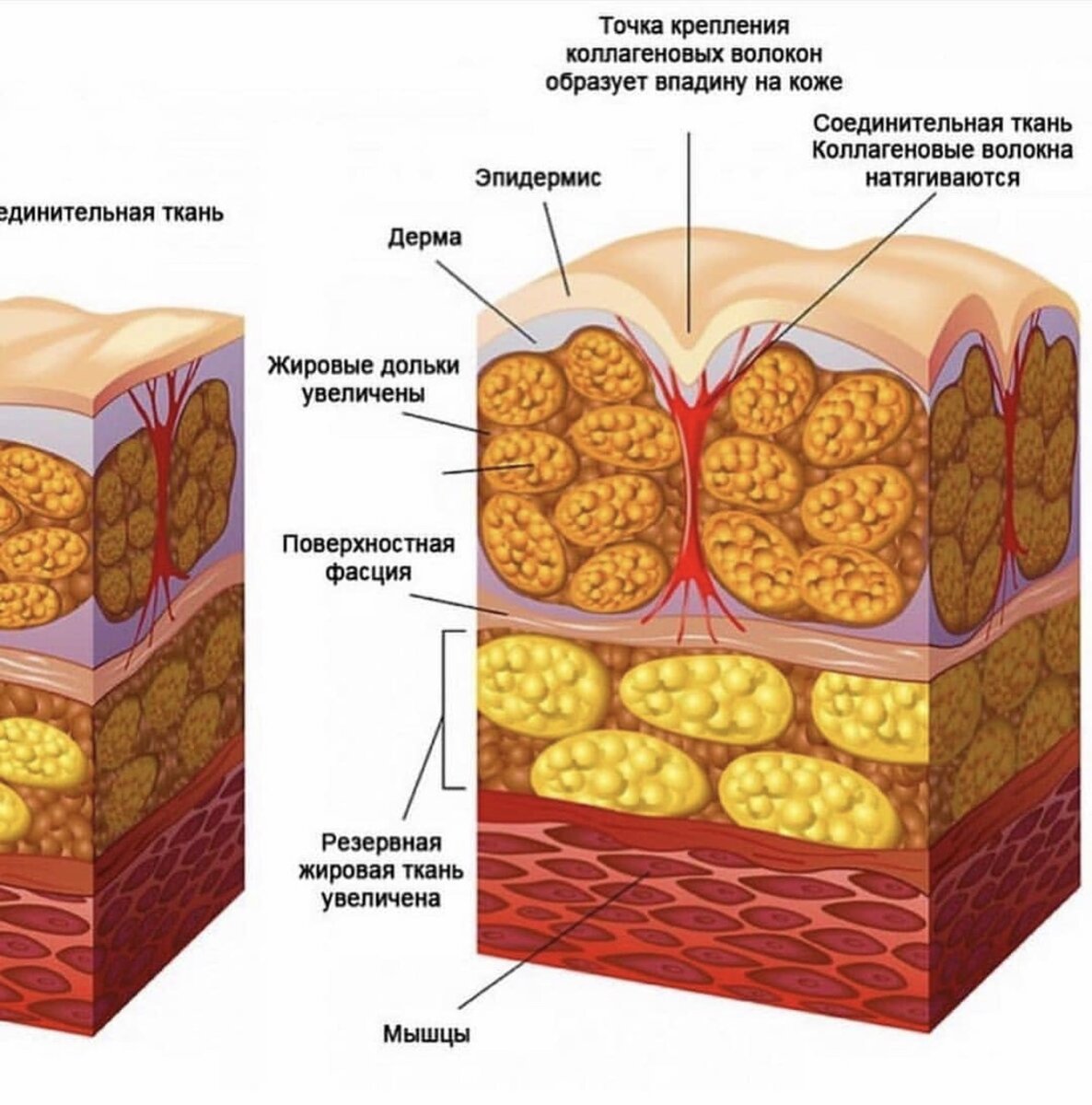 Подкожно жировая клетчатка картинка