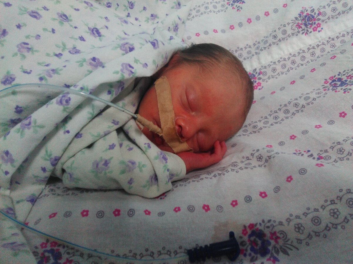 Сын в две недели получал кормление через зонд.