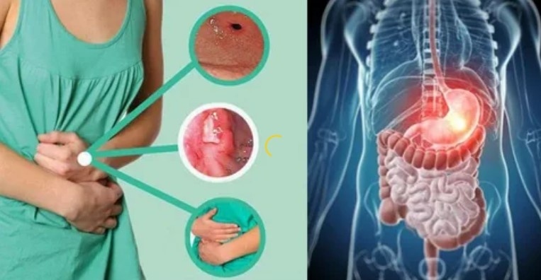 Причины вздутия живота при патологиях