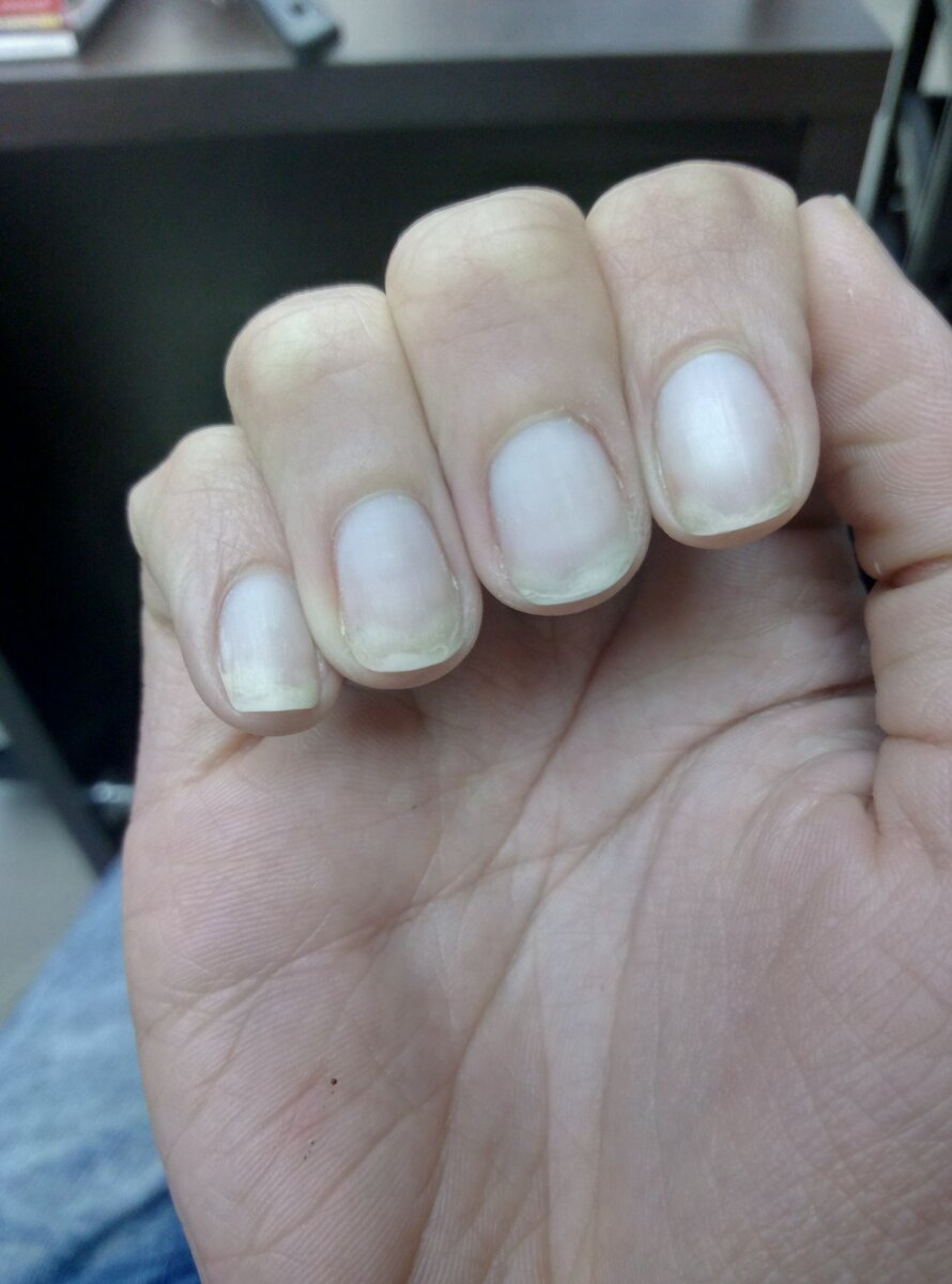 Первая неделя после маникюра