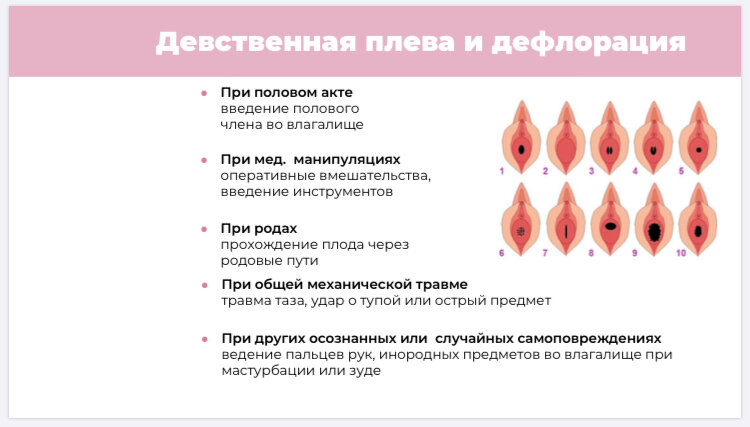 Девствиность всё про целку читаем интереснно, | Приколы, красивые девушки -фото,видео | VK