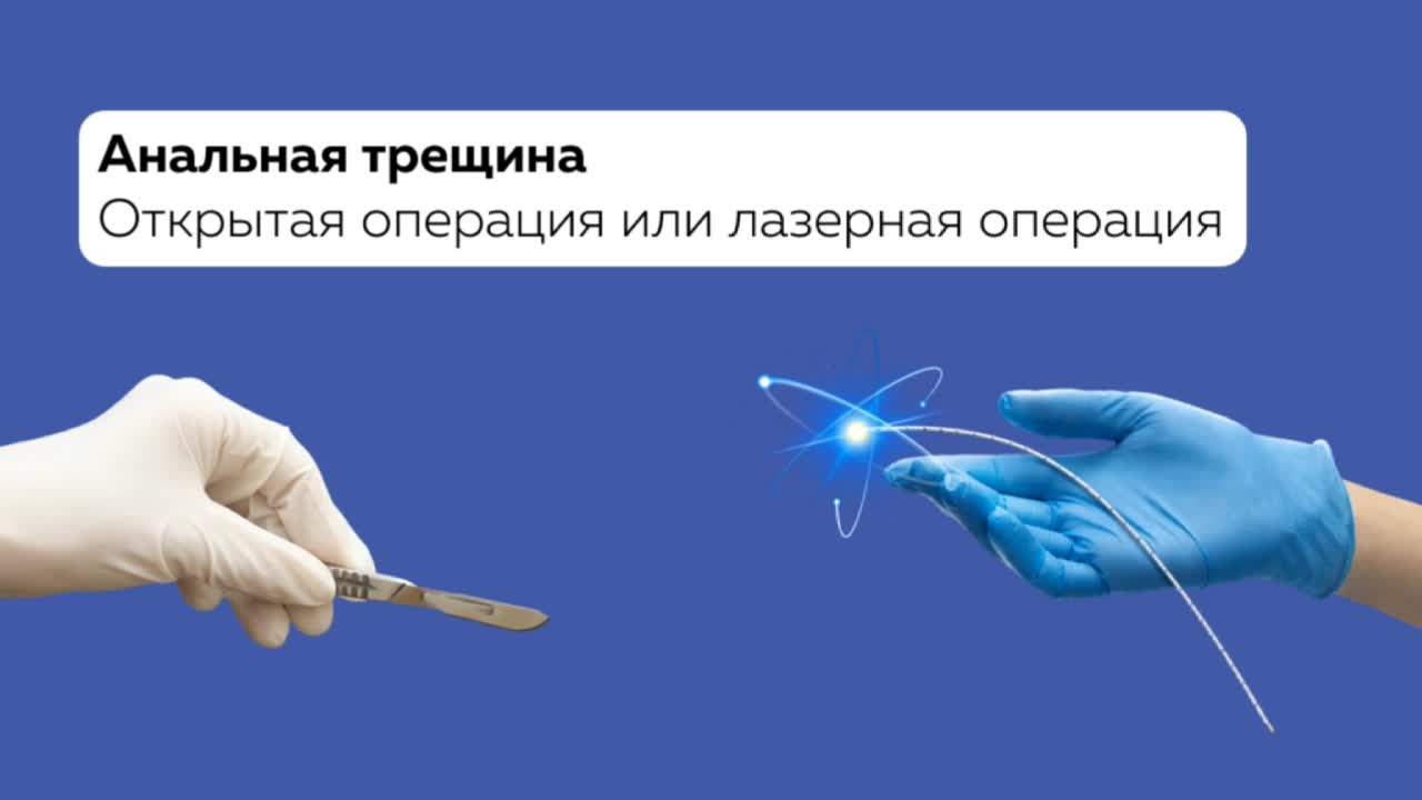 Удаление анальной трещины лазером, операция в Москве - Клиника проктологии Эксперт