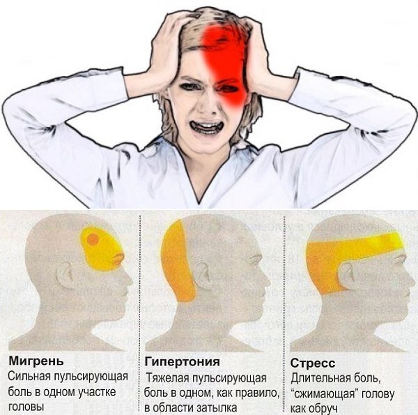 Сильно болит пульсирует