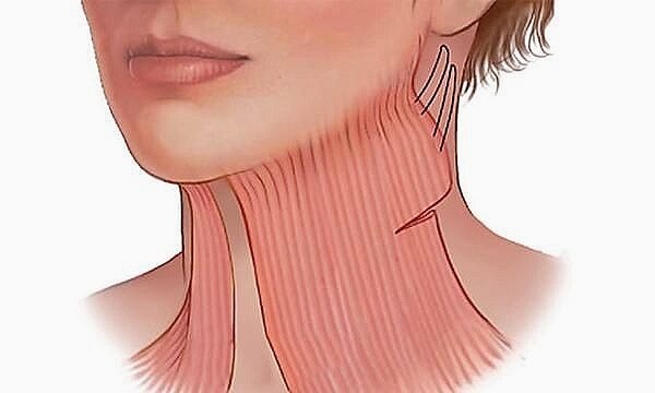 Мышца шеи платизма (от лат. Platysma)