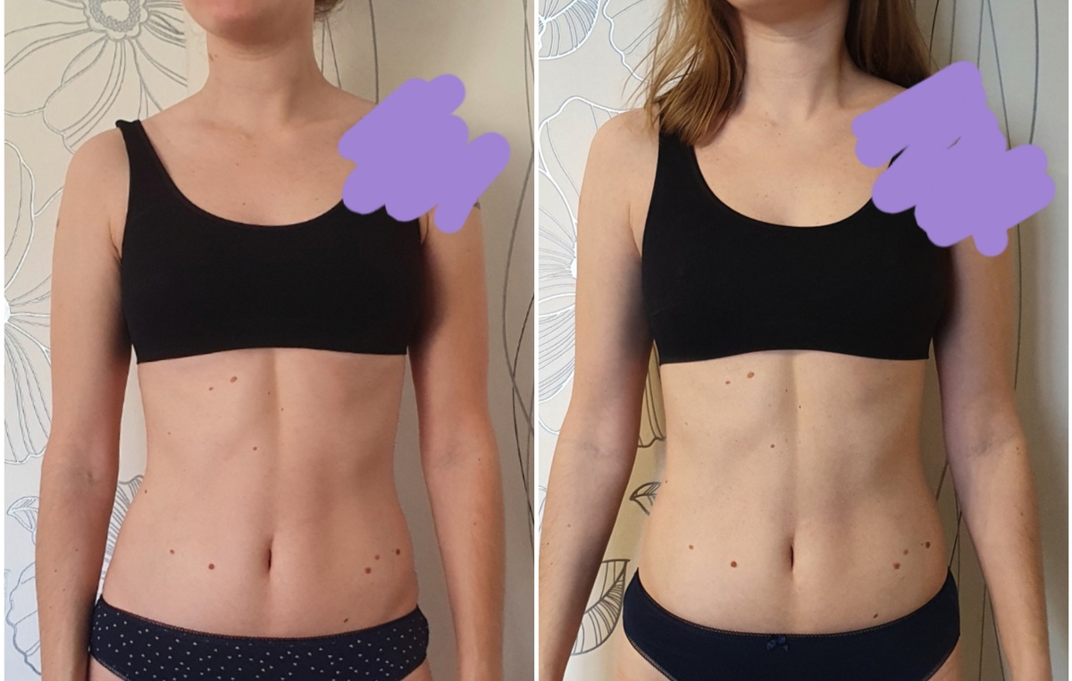 Слева До, справа После