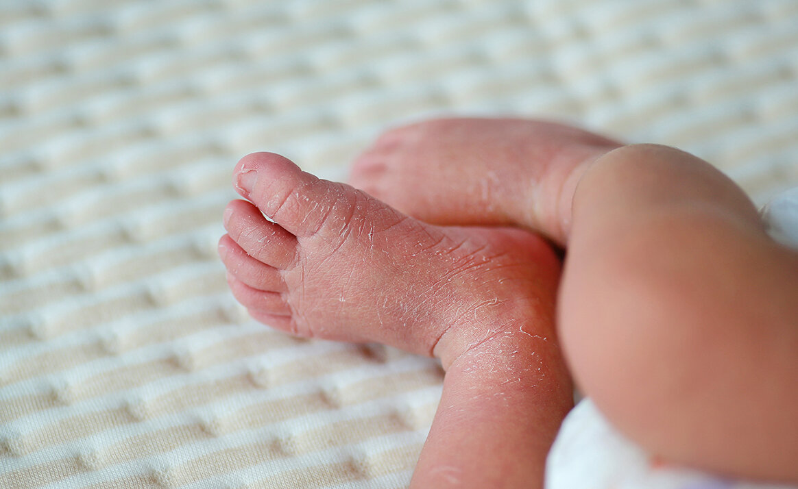 Сухой воздух вредит детям больше, чем взрослым. Детская кожа еще не сформировала защитные функции.