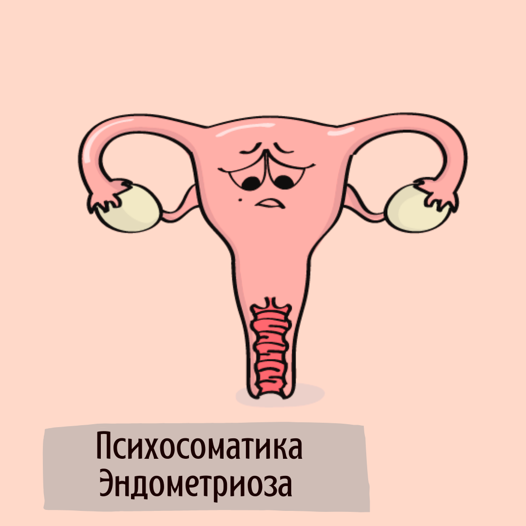 полипы в психосоматике матке психосоматика. гормональная терапия при полипах матки. гормональная терапия при полипе эндометрия. классификация доброкачественных опухолей матки. полип шейки матки психосоматика.