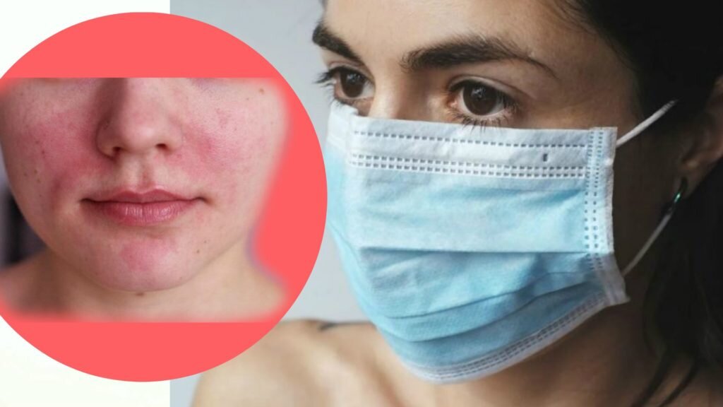 Маскне – что это и как оно возникает? 
