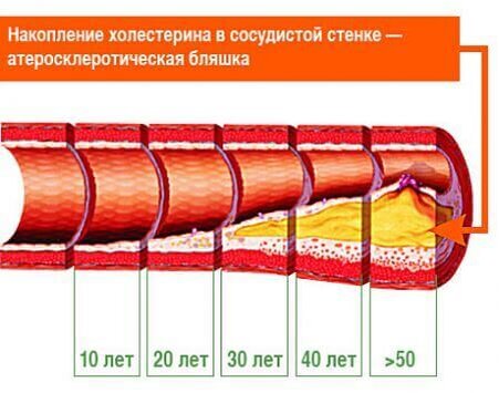 Изображение взято с сайта https://www.meddiagnostica.com.ua/