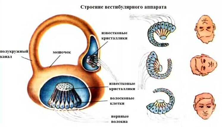 Был опасный случай с моим другом Володей К. Он гулял в парке. Он оступился и после неловкого движения, у него закружилась голова. Ему казалось, что все вокруг уплывало, убегало в сторону. Володя с трудом добрался до лавочки и по смартфону вызвал друзей. Они доставили его домой и вызвали специального врача-отоневролога. Врач приехал, недолго обследовал Володю, сказал, что во внутреннем ухе сместился со своего места один из камешков-отолитов. Потом врач быстрым движением повернул Володину голову, непрерывное головокружение тут же прекратилось. Отолит встал на свое место. 