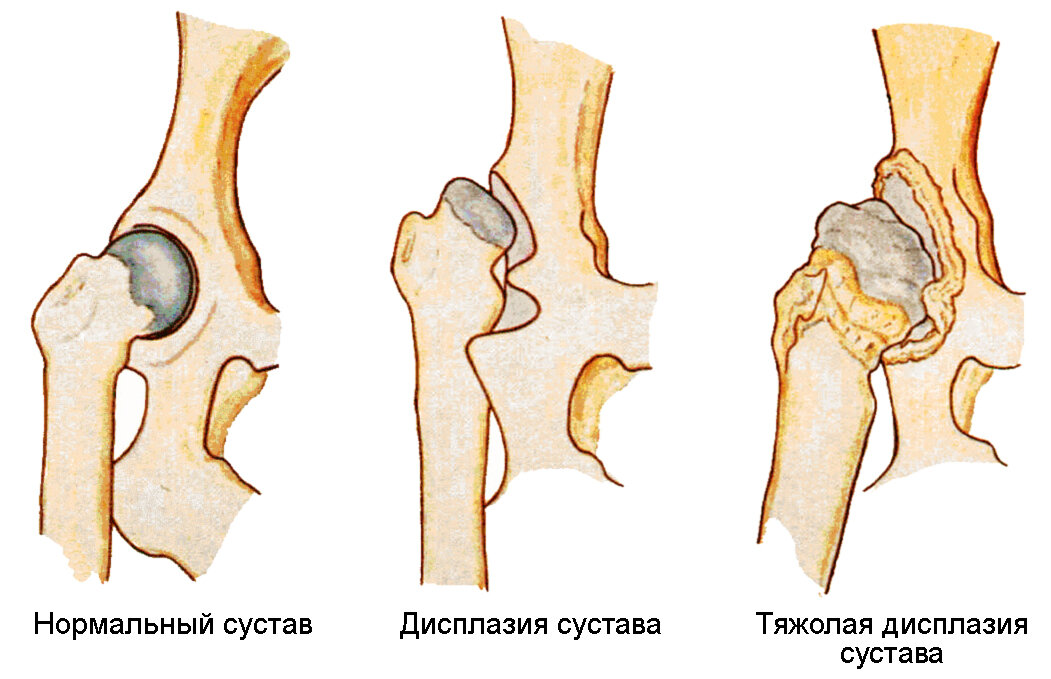 Что происходит с суставом