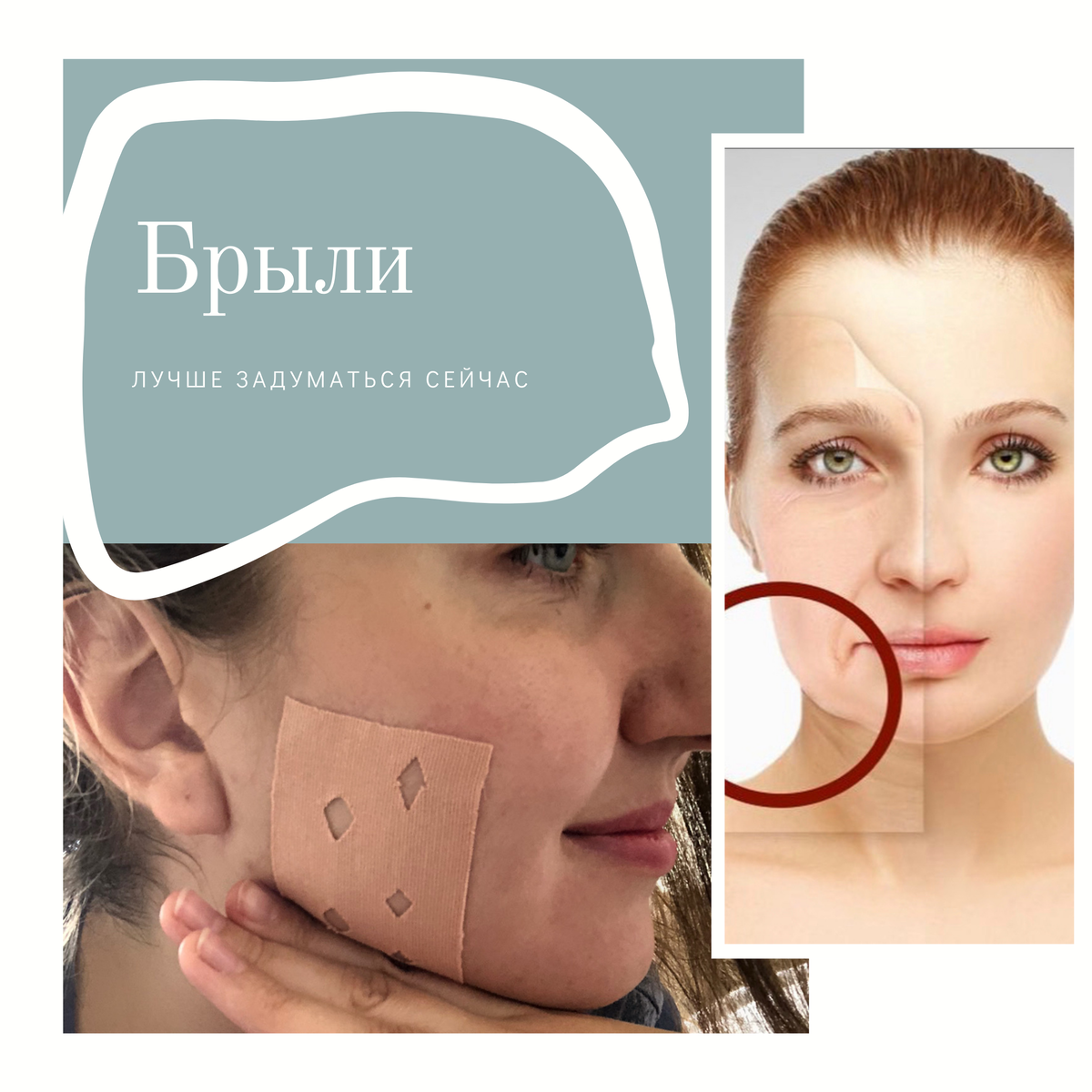 Брыли