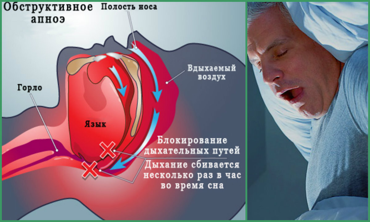 Причины возникновения и лечение