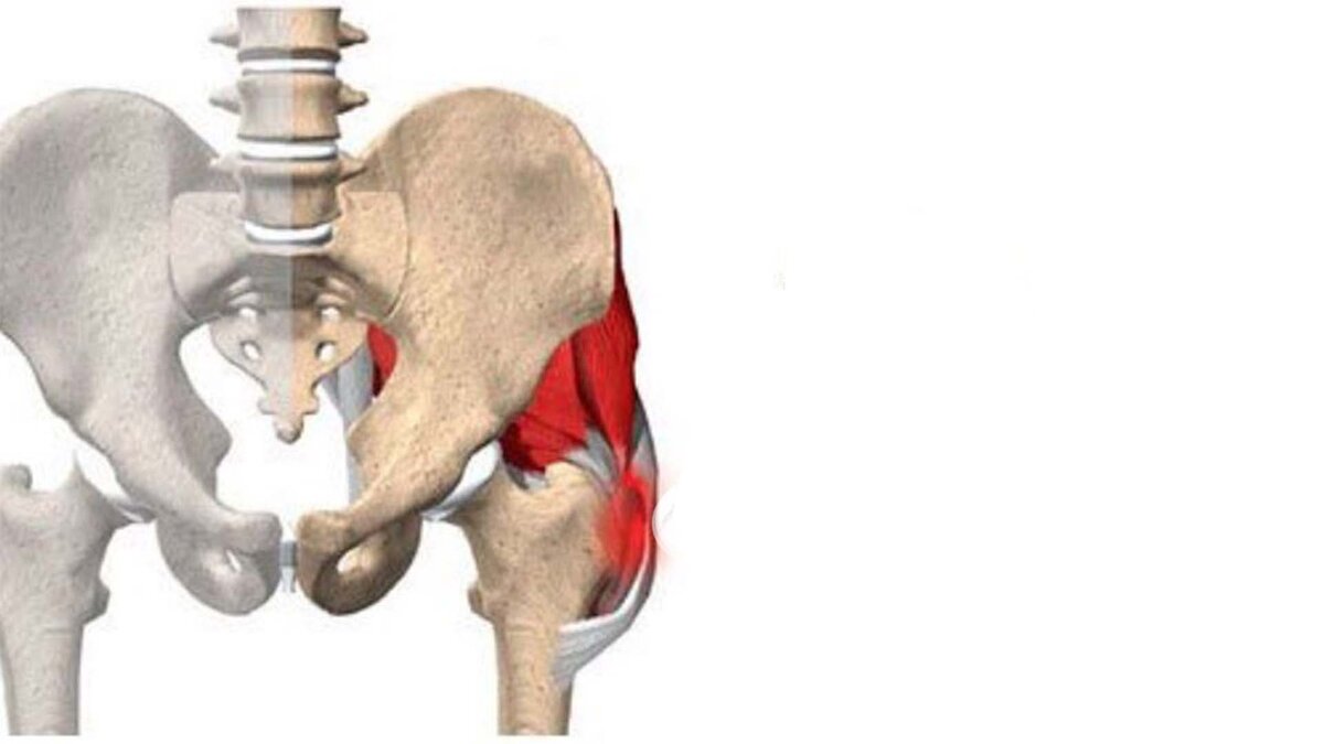Вертельный бурсит тазобедренного сустава фото