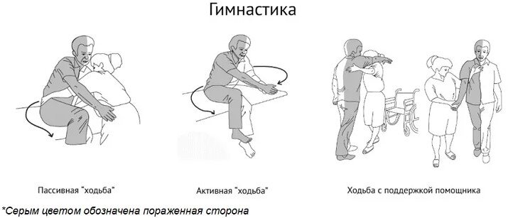 Правильное ли положение больного с инсультом приведенное на рисунке