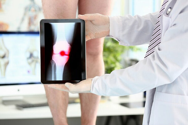Заболевания коленных суставов лечатся долго, поэтому стоит не теряя времени обратиться к врачу