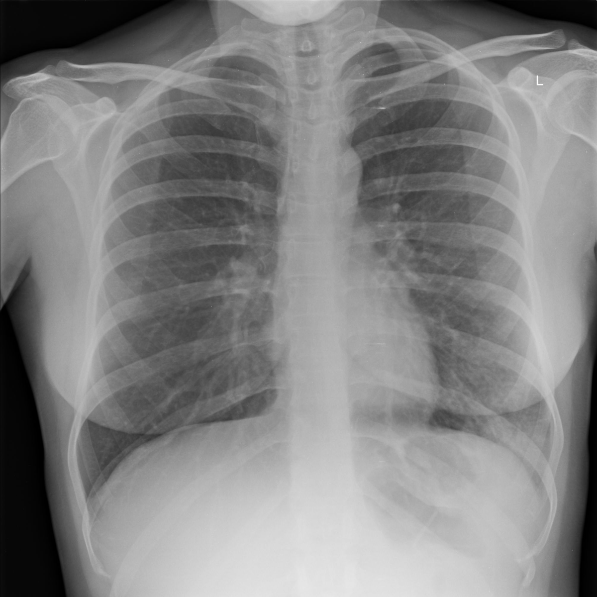 Грудная клетка