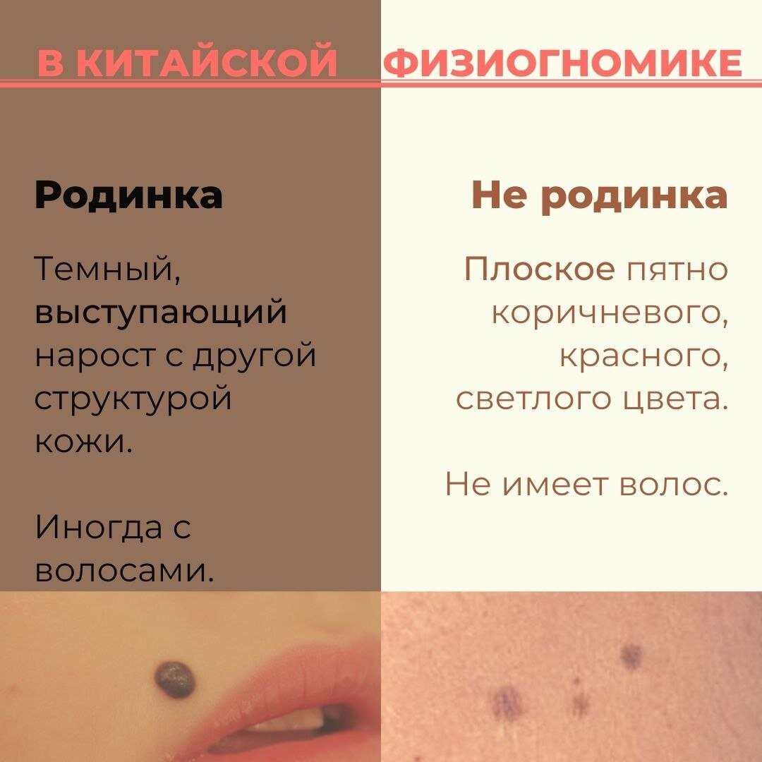 РОДИНКА или не родинка | Physiognomika | Дзен