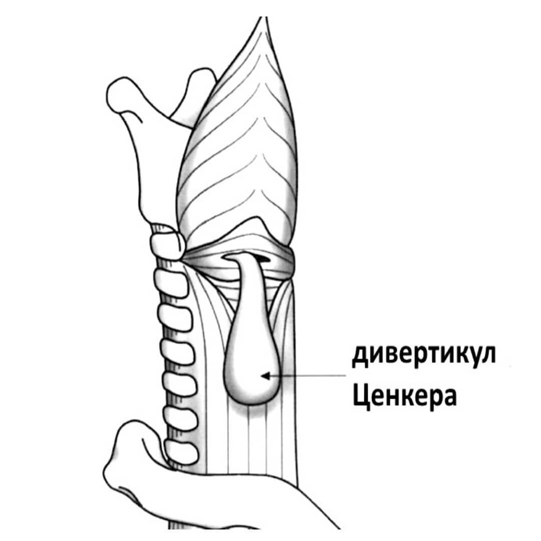 Из открытых источников.